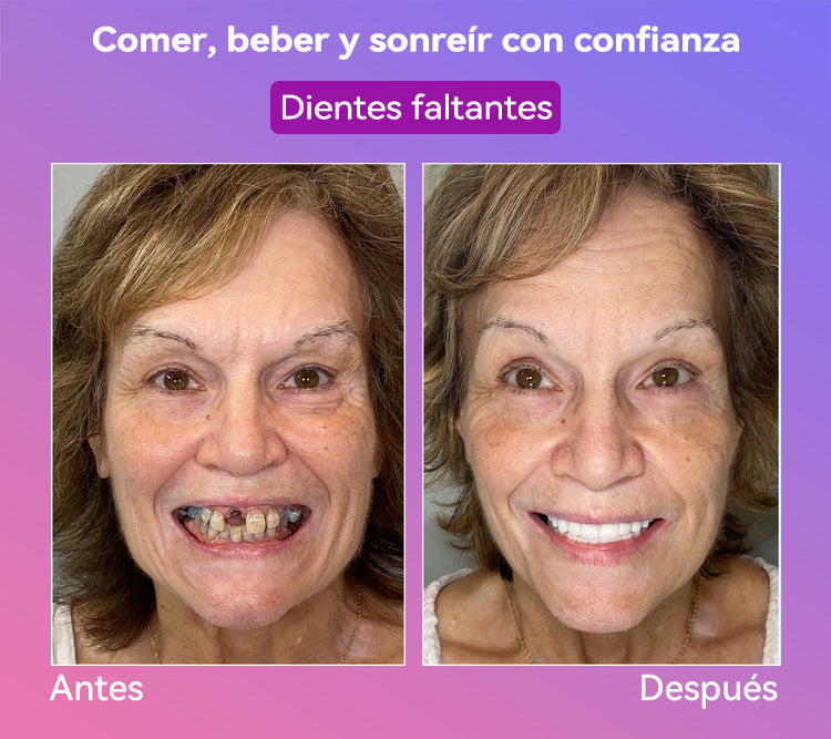 𝐉𝐚𝐬𝐬𝐞𝐞𝐦® Últimas Prótesis Premium de Confort🏆 (Prótesis de Alta Gama, Cómodas de Usar - Descuento por Tiempo Limitado del 70%)🔥