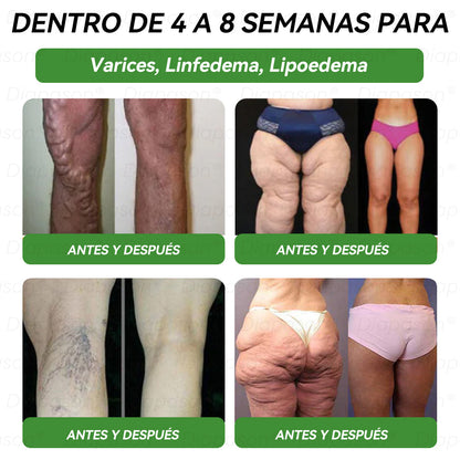 Tienda Oficial🍀 | 𝐃𝒊𝓪𝐩𝓪𝙨𝐨𝒏®Ｇ𝖫𝑃-𝟏 𝑆𝑖𝑒𝑡𝑒 𝑒𝑛 𝑢𝑛𝑜 𝑆𝑜𝑙𝑢𝑐𝑖ó𝑛 𝑃𝑎𝑟𝑎 𝑙𝑎 𝑆𝑎𝑙𝑢𝑑 𝐿í𝑞𝑢𝑖𝑑𝑜 𝑂𝑟𝑎𝑙(Solo una vez al día, cambios visibles en 7 días) Para obesidad, salud cardiovascular, diabetes, apnea del sueño, salud intestinal, problemas articulares y más