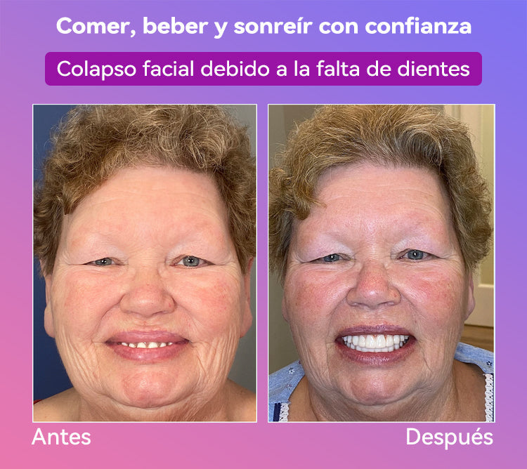 𝐉𝐚𝐬𝐬𝐞𝐞𝐦® Últimas Prótesis Premium de Confort🏆 (Prótesis de Alta Gama, Cómodas de Usar - Descuento por Tiempo Limitado del 70%)🔥