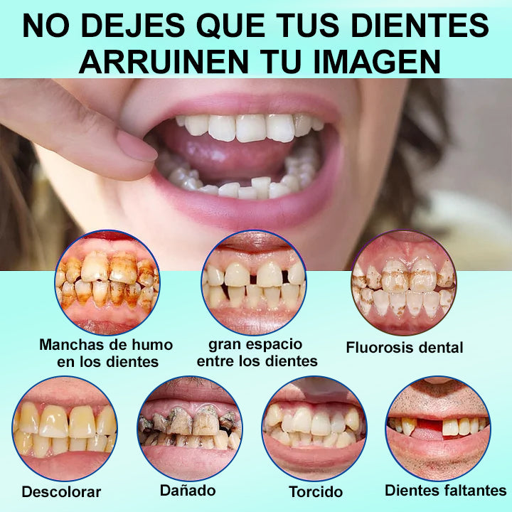 𝐉𝐚𝐬𝐬𝐞𝐞𝐦®🍀𝐷𝑒𝑛𝑡𝑎𝑑𝑢𝑟𝑎 𝑃𝑜𝑠𝑡𝑖𝑧𝑎 𝑃𝑟𝑒𝑚𝑖𝑢𝑚(🦷𝐷𝑒𝑠𝑐𝑢𝑒𝑛𝑡𝑜 𝑝𝑜𝑟 𝑡𝑖𝑒𝑚𝑝𝑜 𝑙𝑖𝑚𝑖𝑡𝑎𝑑𝑜 Ú𝑙𝑡𝑖𝑚𝑜𝑠 30 𝑚𝑖𝑛𝑢𝑡𝑜𝑠🦷)