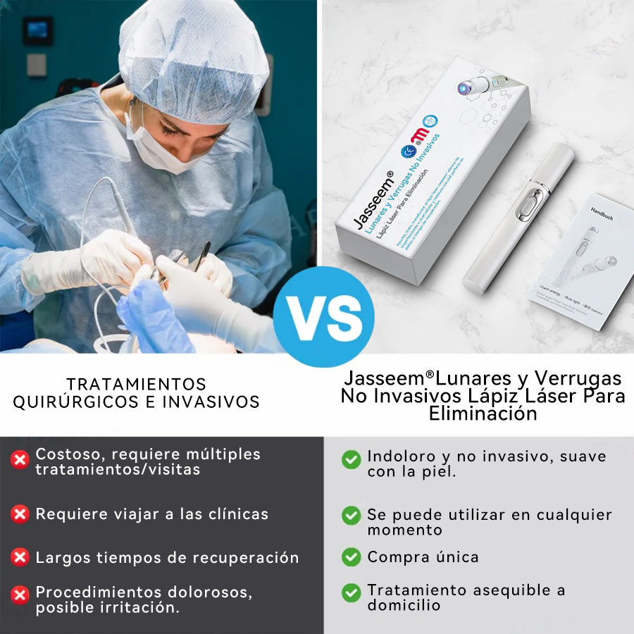 𝐉𝐚𝐬𝐬𝐞𝐞𝐦® Lápiz Láser de Grado Médico 🎁🎁 (Tecnología Láser de Dióxido de Carbono – Eficaz para Eliminar Lunares, Verrugas, Excesos de Piel, Manchas de Pigmentación y Otros Defectos de la Piel)