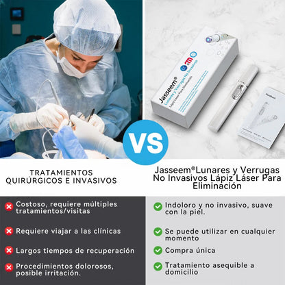 𝐉𝐚𝐬𝐬𝐞𝐞𝐦® Lápiz Láser de Grado Médico 🎁🎁 (Tecnología Láser de Dióxido de Carbono – Eficaz para Eliminar Lunares, Verrugas, Excesos de Piel, Manchas de Pigmentación y Otros Defectos de la Piel)
