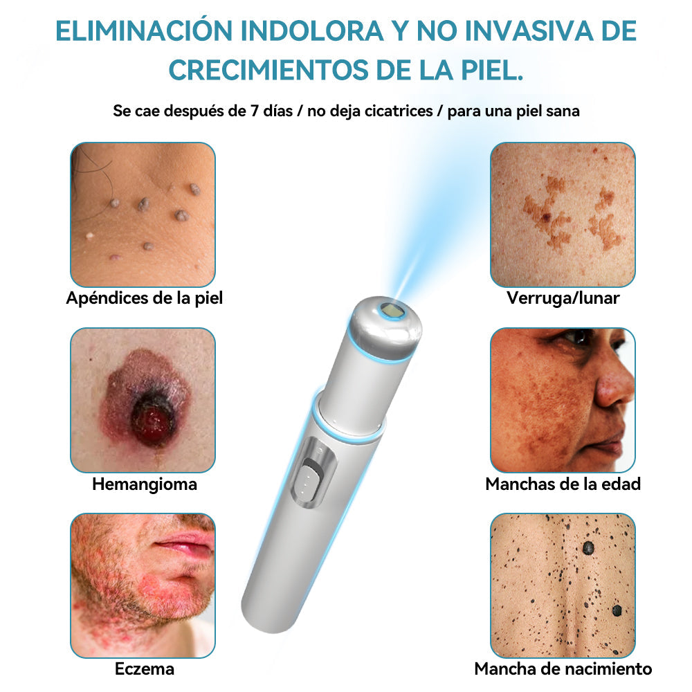 𝐉𝐚𝐬𝐬𝐞𝐞𝐦® Lápiz Láser de Grado Médico 🎁🎁 (Tecnología Láser de Dióxido de Carbono – Eficaz para Eliminar Lunares, Verrugas, Excesos de Piel, Manchas de Pigmentación y Otros Defectos de la Piel)