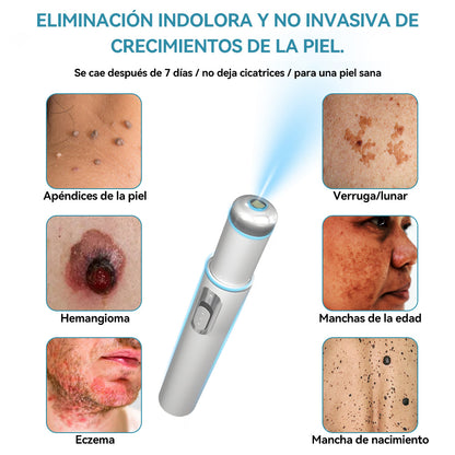 𝐉𝐚𝐬𝐬𝐞𝐞𝐦® Lápiz Láser de Grado Médico 🎁🎁 (Tecnología Láser de Dióxido de Carbono – Eficaz para Eliminar Lunares, Verrugas, Excesos de Piel, Manchas de Pigmentación y Otros Defectos de la Piel)