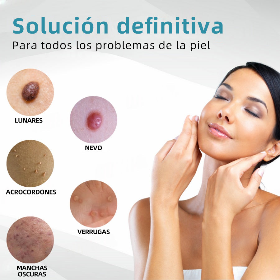 𝐉𝐚𝐬𝐬𝐞𝐞𝐦® Lápiz Láser de Grado Médico 🎁🎁 (Tecnología Láser de Dióxido de Carbono – Eficaz para Eliminar Lunares, Verrugas, Excesos de Piel, Manchas de Pigmentación y Otros Defectos de la Piel)