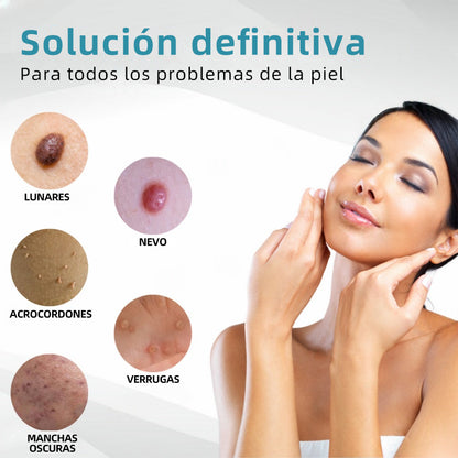 𝐉𝐚𝐬𝐬𝐞𝐞𝐦® Lápiz Láser de Grado Médico 🎁🎁 (Tecnología Láser de Dióxido de Carbono – Eficaz para Eliminar Lunares, Verrugas, Excesos de Piel, Manchas de Pigmentación y Otros Defectos de la Piel)