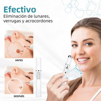 𝐉𝐚𝐬𝐬𝐞𝐞𝐦® Lápiz Láser de Grado Médico 🎁🎁 (Tecnología Láser de Dióxido de Carbono – Eficaz para Eliminar Lunares, Verrugas, Excesos de Piel, Manchas de Pigmentación y Otros Defectos de la Piel)