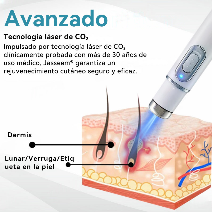 𝐉𝐚𝐬𝐬𝐞𝐞𝐦® Lápiz Láser de Grado Médico 🎁🎁 (Tecnología Láser de Dióxido de Carbono – Eficaz para Eliminar Lunares, Verrugas, Excesos de Piel, Manchas de Pigmentación y Otros Defectos de la Piel)