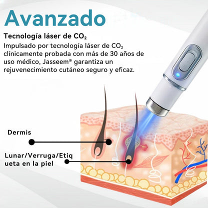 𝐉𝐚𝐬𝐬𝐞𝐞𝐦® Lápiz Láser de Grado Médico 🎁🎁 (Tecnología Láser de Dióxido de Carbono – Eficaz para Eliminar Lunares, Verrugas, Excesos de Piel, Manchas de Pigmentación y Otros Defectos de la Piel)